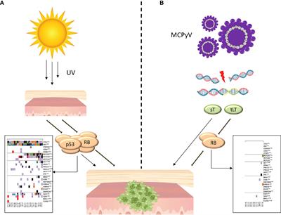 Merkel Cell Carcinoma: An Immunotherapy Fairy-Tale?